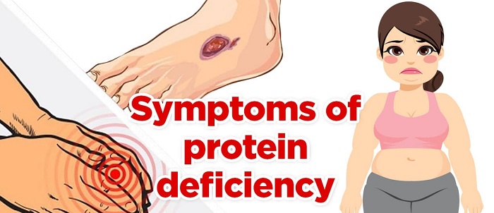 signs of protein deficiency